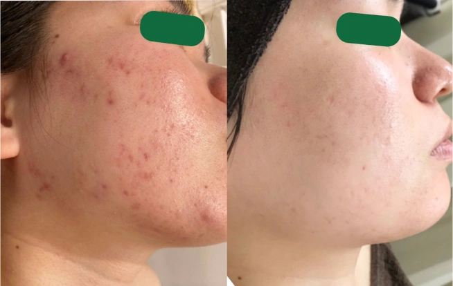 オプション症例写真